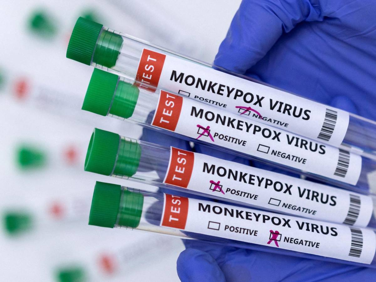 Guatemala: Ministerio de Salud confirma el primer caso de viruela del mono en el país