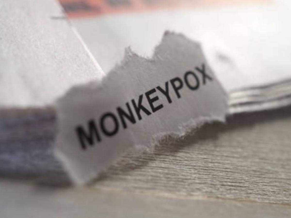 Honduras confirma primer caso de viruela del mono