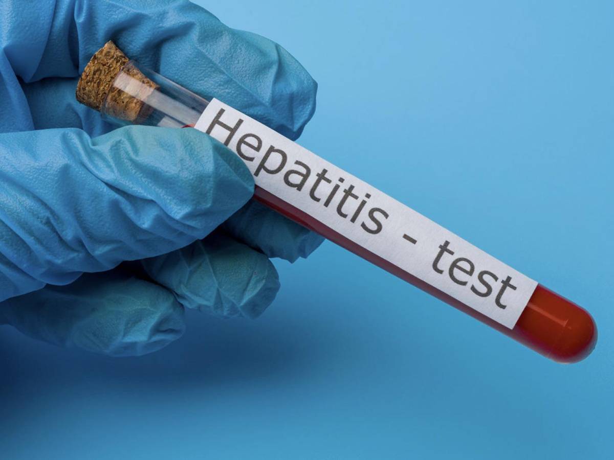 OMS: El mundo se enfrenta a un brote de hepatitis ‘de origen desconocido’ que afecta a niños