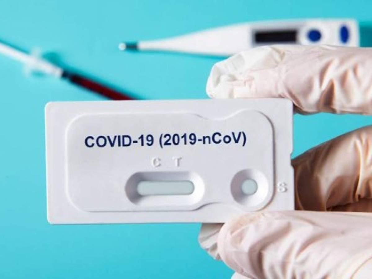 Costa Rica: Sector Privado dona a la CCSS máquinas de pruebas para COVID-19