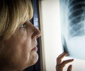 Enfermedad Pulmonar Obstructiva Crónica (EPOC): tercera causa de muerte a nivel mundial