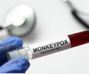EEUU bajo emergencia sanitaria nacional por viruela del mono