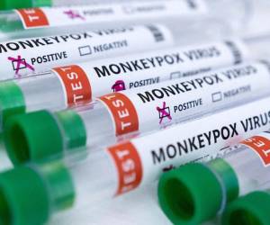 La OMS eleva a más de 9.200 los casos de viruela del mono en todo el mundo