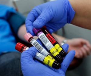 Blood samples donated by recovered novel coronavirus patients for plasma extraction, contributing to Israel's new experimental antibodies treatment, are collected by Magen David Adoms Blood Services in Sheba Medical Center Hospital near Tel Aviv, on June 1, 2020. (Photo by GIL COHEN-MAGEN / AFP)