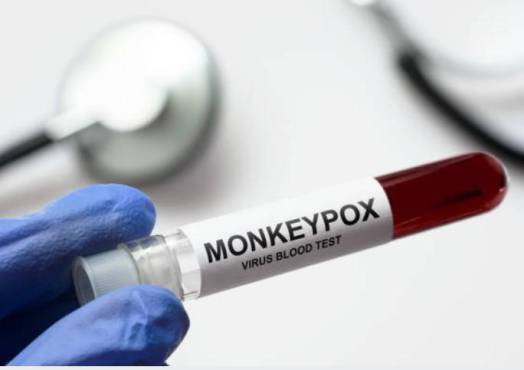 EEUU bajo emergencia sanitaria nacional por viruela del mono