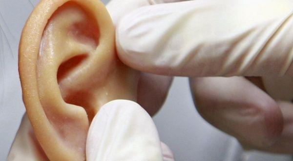 Transplantan por primera vez una oreja impresa en 3D