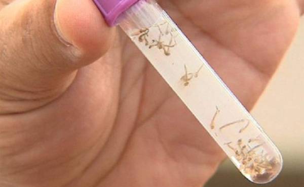 El Salvador aprueba registro de primera vacuna contra dengue